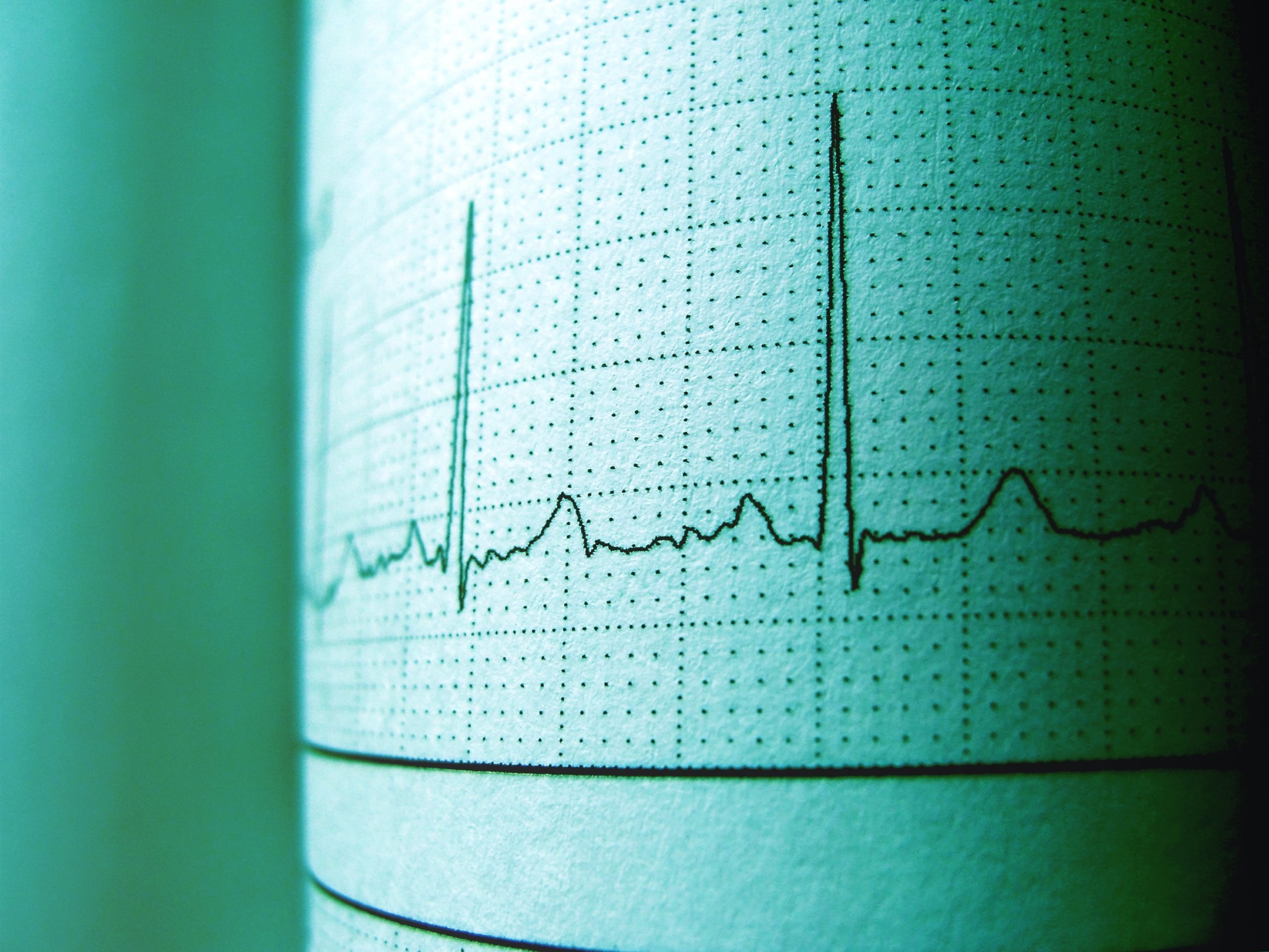 Electrocardiogram, Heartbeat Wallpaper, 2560x1920 HD Desktop