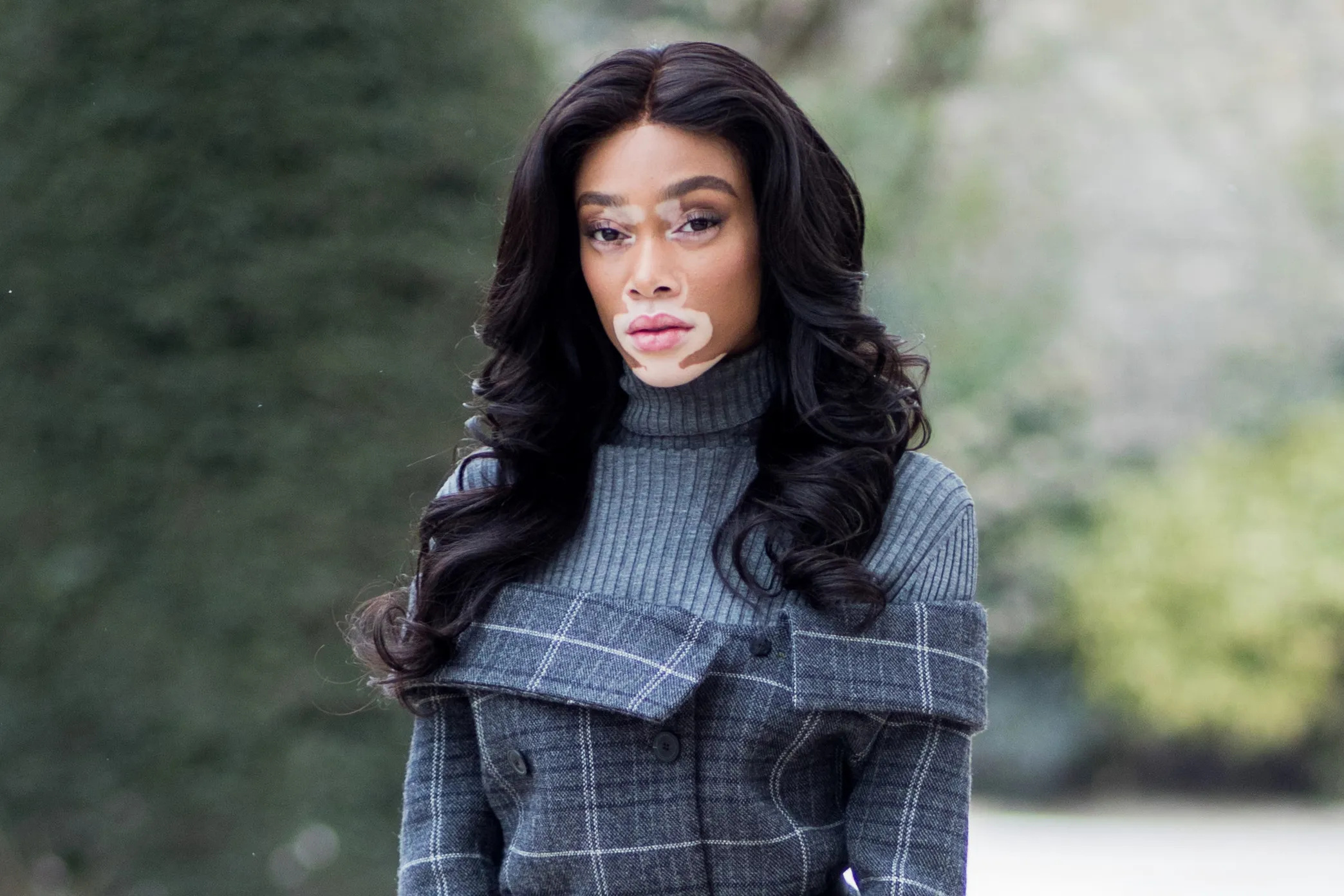 Winnie Harlow, Model sensation, Vitiligo advocate, Inspirational beauty, 2090x1400 HD Desktop