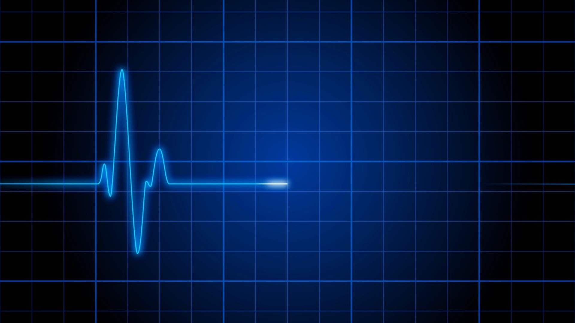 EKG pattern, Heartbeat Wallpaper, 1920x1080 Full HD Desktop