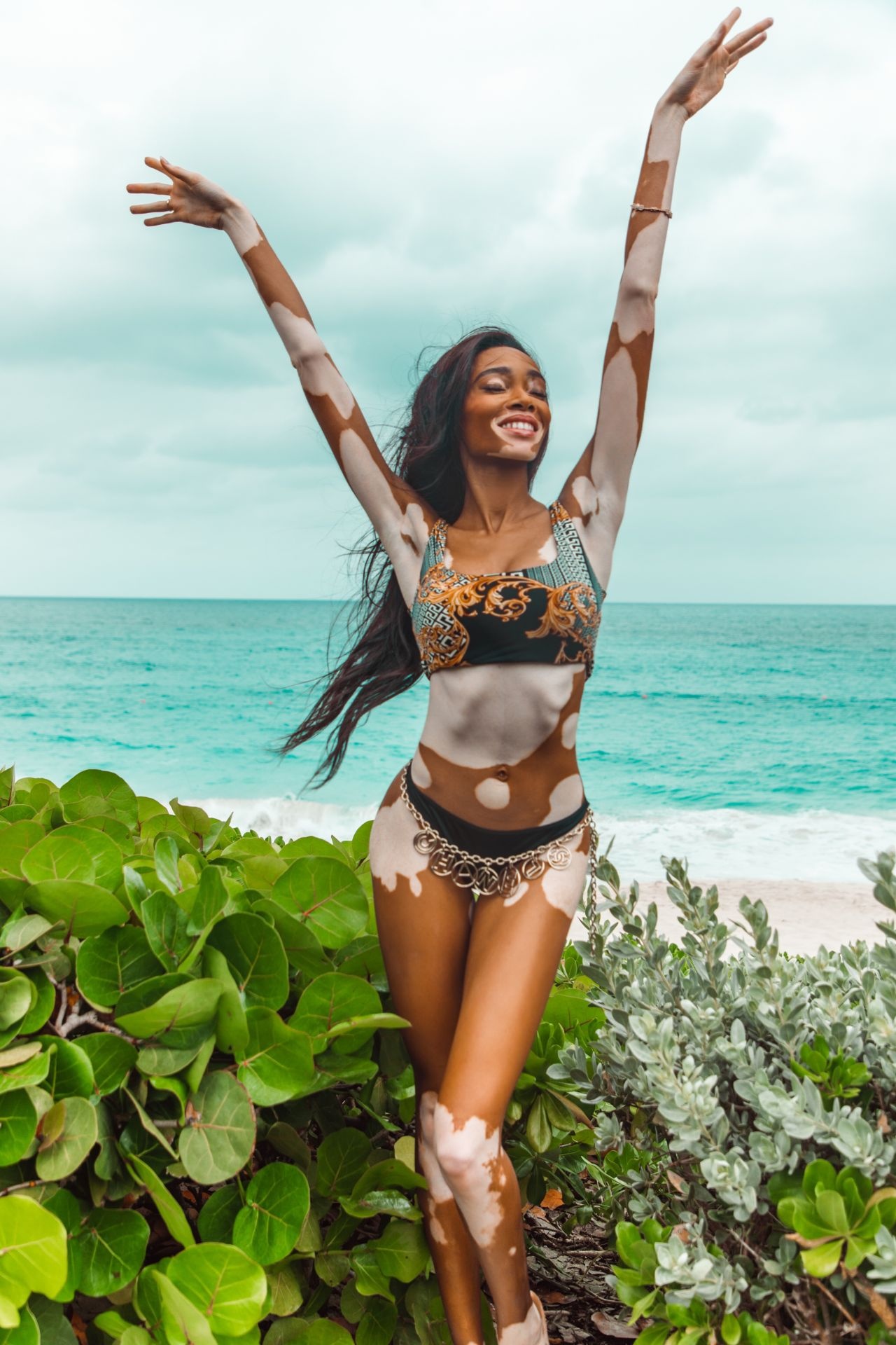 Winnie Harlow, Bikini, V Magazine, Photos, 1280x1920 HD Phone